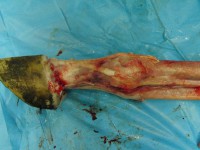 /album/anatomie-distalni-casti-koncetiny-podkovarska-skola-s-r-o-/cimg3211-jpg/
