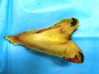/album/anatomie-distalni-casti-koncetiny-podkovarska-skola-s-r-o-/cimg3219-jpg/